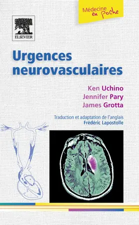 Lapostolle / Uchino / Pary |  Urgences neurovasculaires | eBook | Sack Fachmedien