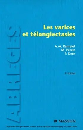 Ramelet / Perrin / Kern |  Les varices et télangiectasies | eBook | Sack Fachmedien