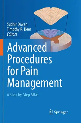 Diwan / Deer |  Advanced Procedures for Pain Management | Buch |  Sack Fachmedien