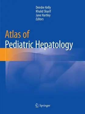 Kelly / Hartley / Sharif |  Atlas of Pediatric Hepatology | Buch |  Sack Fachmedien