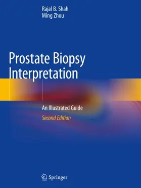 Zhou / Shah |  Prostate Biopsy Interpretation | Buch |  Sack Fachmedien