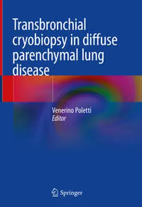 Poletti |  Transbronchial cryobiopsy in diffuse parenchymal lung disease | Buch |  Sack Fachmedien