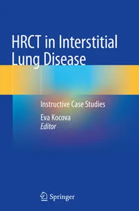 Kocova |  HRCT in Interstitial Lung Disease | Buch |  Sack Fachmedien