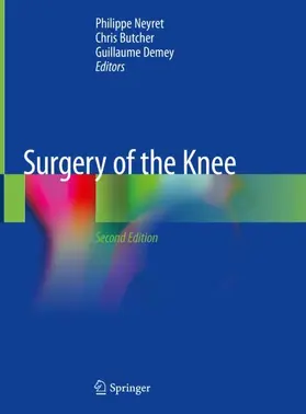 Neyret / Demey / Butcher |  Surgery of the Knee | Buch |  Sack Fachmedien