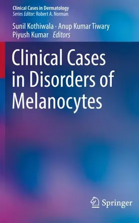 Kothiwala / Kumar / Kumar Tiwary |  Clinical Cases in Disorders of Melanocytes | Buch |  Sack Fachmedien