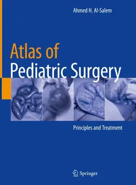 Al-Salem |  Atlas of Pediatric Surgery | Buch |  Sack Fachmedien