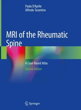 Tarantino / D'Aprile |  MRI of the Rheumatic Spine | Buch |  Sack Fachmedien