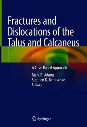 Benirschke / Adams |  Fractures and Dislocations of the Talus and Calcaneus | Buch |  Sack Fachmedien