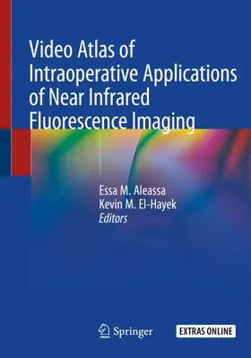 El-Hayek / Aleassa |  Video Atlas of Intraoperative Applications of Near Infrared Fluorescence Imaging | Buch |  Sack Fachmedien