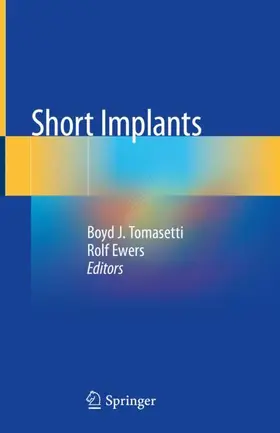 Ewers / Tomasetti | Short Implants | Buch | 978-3-030-44198-2 | sack.de