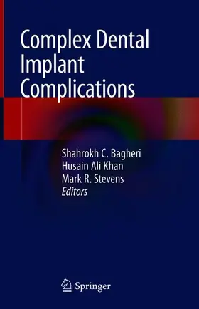 Bagheri / Stevens / Khan |  Complex Dental Implant Complications | Buch |  Sack Fachmedien