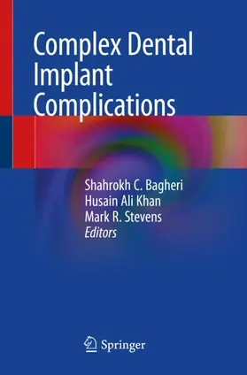 Bagheri / Stevens / Khan |  Complex Dental Implant Complications | Buch |  Sack Fachmedien