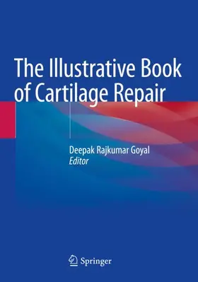 Goyal |  The Illustrative Book of Cartilage Repair | Buch |  Sack Fachmedien