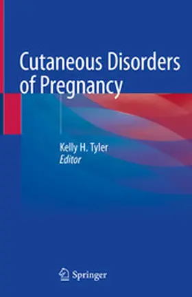 Tyler | Cutaneous Disorders of Pregnancy | E-Book | www2.sack.de
