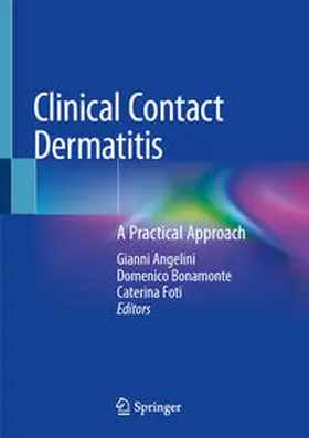 Angelini / Bonamonte / Foti | Clinical Contact Dermatitis | E-Book | sack.de