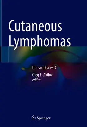 Akilov | Cutaneous Lymphomas | E-Book | sack.de