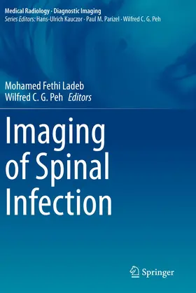 Ladeb / Peh |  Imaging of Spinal Infection | Buch |  Sack Fachmedien
