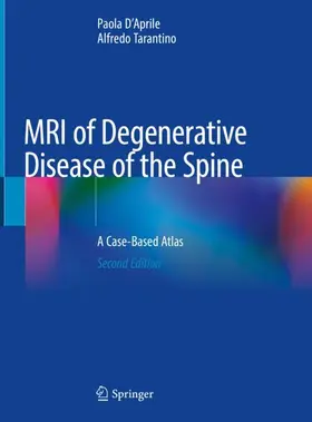 Tarantino / D'Aprile |  MRI of Degenerative Disease of the Spine | Buch |  Sack Fachmedien