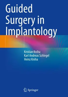 Kniha / Schlegel |  Guided Surgery in Implantology | Buch |  Sack Fachmedien