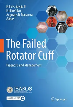 Savoie III / Calvo / Mazzocca |  The Failed Rotator Cuff | eBook | Sack Fachmedien