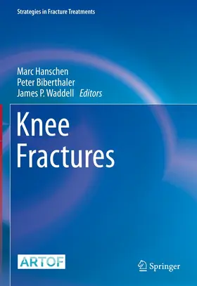 Hanschen / Biberthaler / Waddell |  Knee Fractures | eBook | Sack Fachmedien