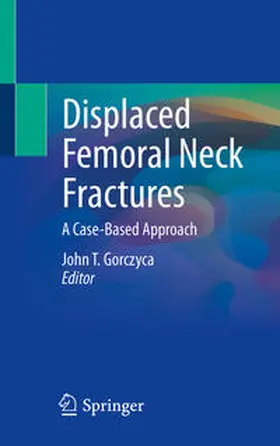 Gorczyca |  Displaced Femoral Neck Fractures | Buch |  Sack Fachmedien