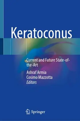 Armia / Mazzotta |  Keratoconus | Buch |  Sack Fachmedien