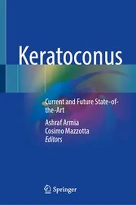Armia / Mazzotta |  Keratoconus | eBook | Sack Fachmedien