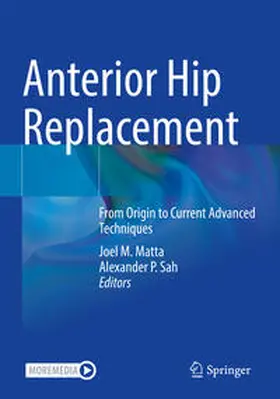 Sah / Matta | Anterior Hip Replacement | Buch | 978-3-030-91898-9 | sack.de