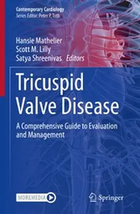 Mathelier / Lilly / Shreenivas |  Tricuspid Valve Disease | eBook | Sack Fachmedien