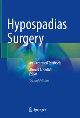 Hadidi |  Hypospadias Surgery | eBook | Sack Fachmedien