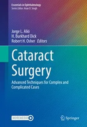Alió / Dick / Osher |  Cataract Surgery | eBook | Sack Fachmedien