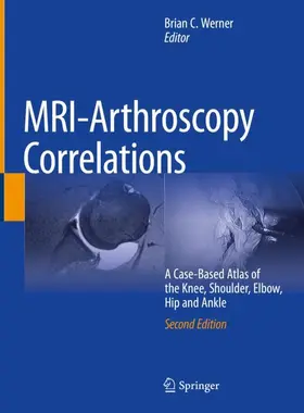 Werner |  MRI-Arthroscopy Correlations | Buch |  Sack Fachmedien