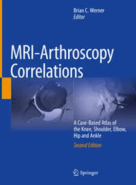 Werner | MRI-Arthroscopy Correlations | E-Book | sack.de