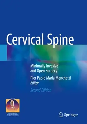 Menchetti |  Cervical Spine | Buch |  Sack Fachmedien