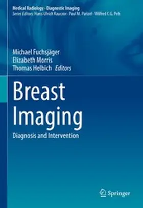 Fuchsjäger / Morris / Helbich |  Breast Imaging | eBook | Sack Fachmedien