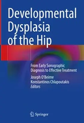 O'Beirne / Chlapoutakis | Developmental Dysplasia of the Hip | E-Book | www2.sack.de