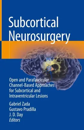 Zada / Day / Pradilla |  Subcortical Neurosurgery | Buch |  Sack Fachmedien