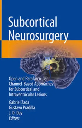 Zada / Pradilla / Day |  Subcortical Neurosurgery | eBook | Sack Fachmedien