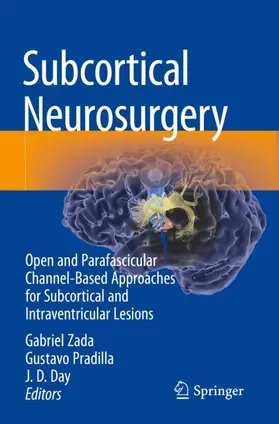 Zada / Day / Pradilla |  Subcortical Neurosurgery | Buch |  Sack Fachmedien