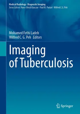 Ladeb / Peh |  Imaging of Tuberculosis | Buch |  Sack Fachmedien