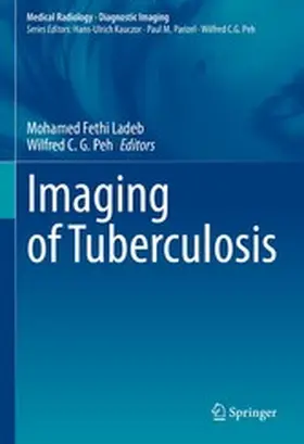 Ladeb / Peh |  Imaging of Tuberculosis | eBook | Sack Fachmedien