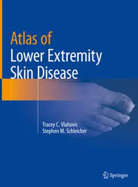 Vlahovic / Schleicher |  Atlas of Lower Extremity Skin Disease | eBook | Sack Fachmedien