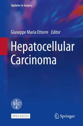 Ettorre |  Hepatocellular Carcinoma | Buch |  Sack Fachmedien