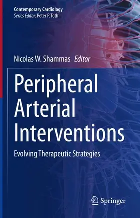 Shammas |  Peripheral Arterial Interventions | Buch |  Sack Fachmedien