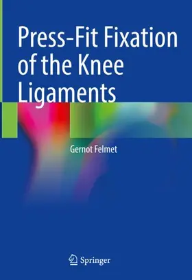 Felmet |  Press-Fit Fixation of the Knee Ligaments | Buch |  Sack Fachmedien