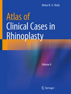 Shafy | Atlas of Clinical Cases in Rhinoplasty | E-Book | sack.de