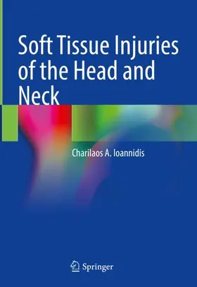 Ioannidis |  Soft Tissue Injuries of the Head and Neck | Buch |  Sack Fachmedien