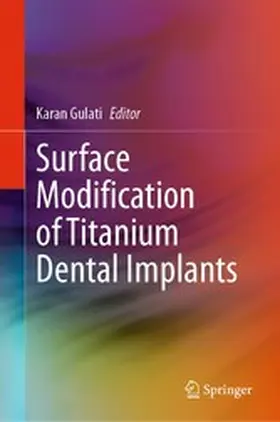 Gulati |  Surface Modification of Titanium Dental Implants | eBook | Sack Fachmedien