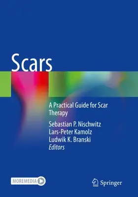 Nischwitz / Kamolz / Branski |  Scars | Buch |  Sack Fachmedien